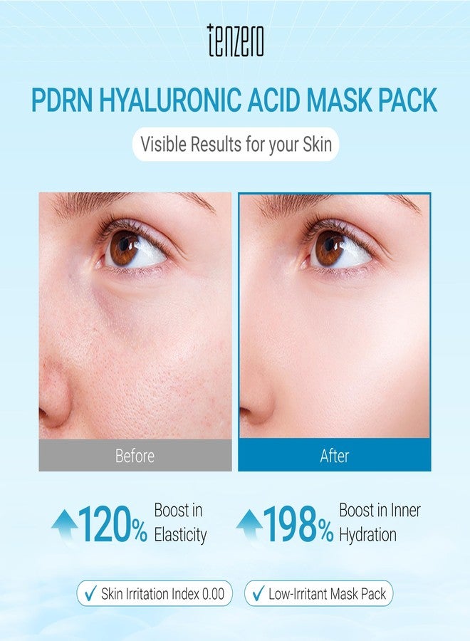 tenzero Watery Hyaluronic Acid PDRN Mask Pack (3 Sheets x 30g), Overnight Hydrogel Mask, Deep Hydrating, Elasticity Enhancing, Soothing For Sensitive Skin with Centella PDRN, Hyaluronic Acid - Image 2